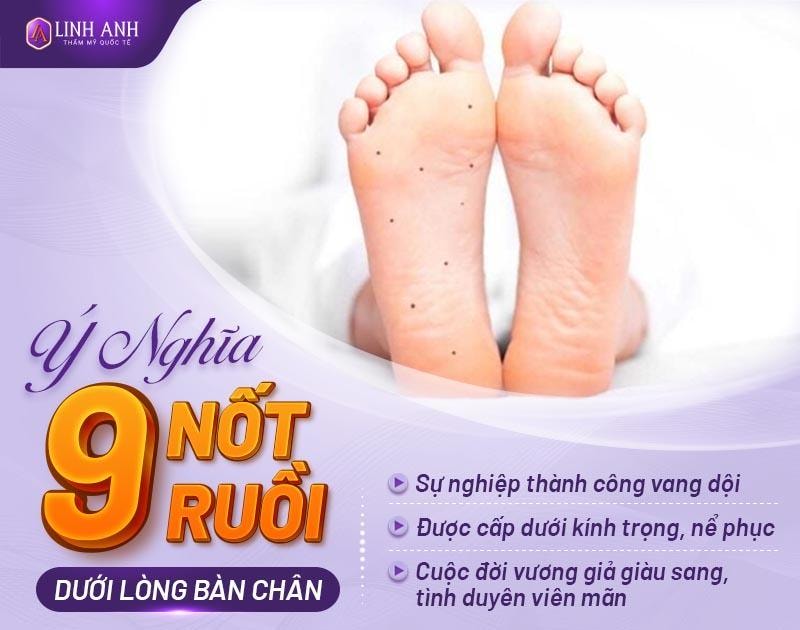 Ý nghĩa 9 nốt ruồi ở lòng bàn chân