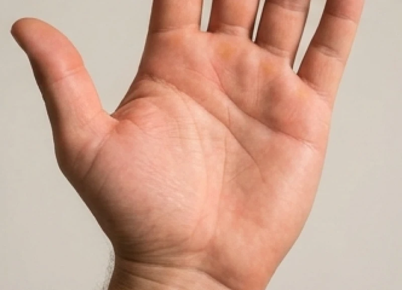 Bàn tay dày dặn với sắc da hồng hào phản ánh sinh lực và sức đề kháng dồi dào