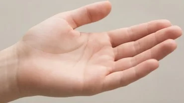 Lòng bàn tay không có đường chỉ tay trơn láng bẩm sinh thể hiện sự đặc biệt về di truyền