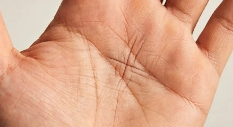 Lòng bàn tay hiển thị rõ ba đường rẽ ngang cùng vân chữ X nằm giữa đường Trí đạo và Tâm đạo