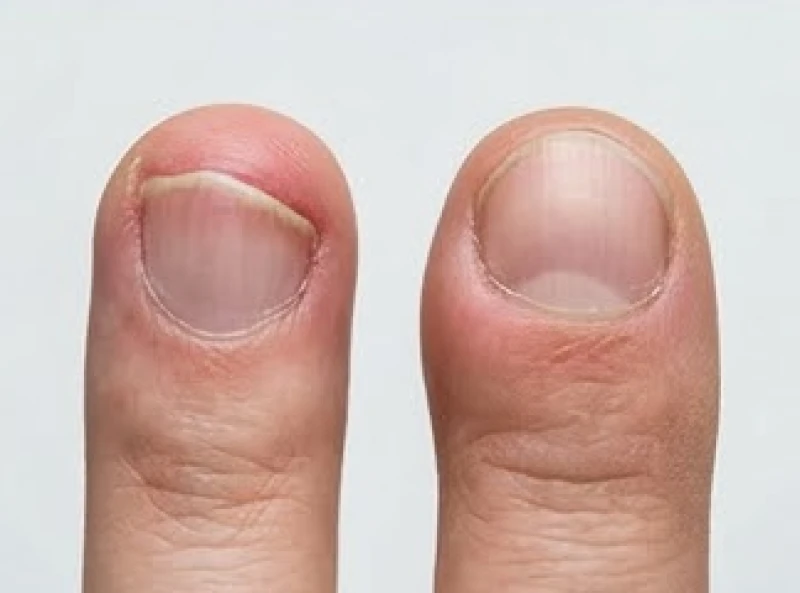 Sự thay đổi độ cong của móng tay một cách nhanh chóng là tín hiệu nguy hiểm