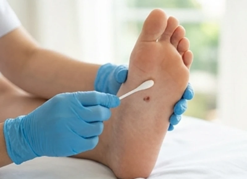 Bôi một lớp thuốc mỡ kháng sinh mỏng lên vùng da vừa được điều trị laser
