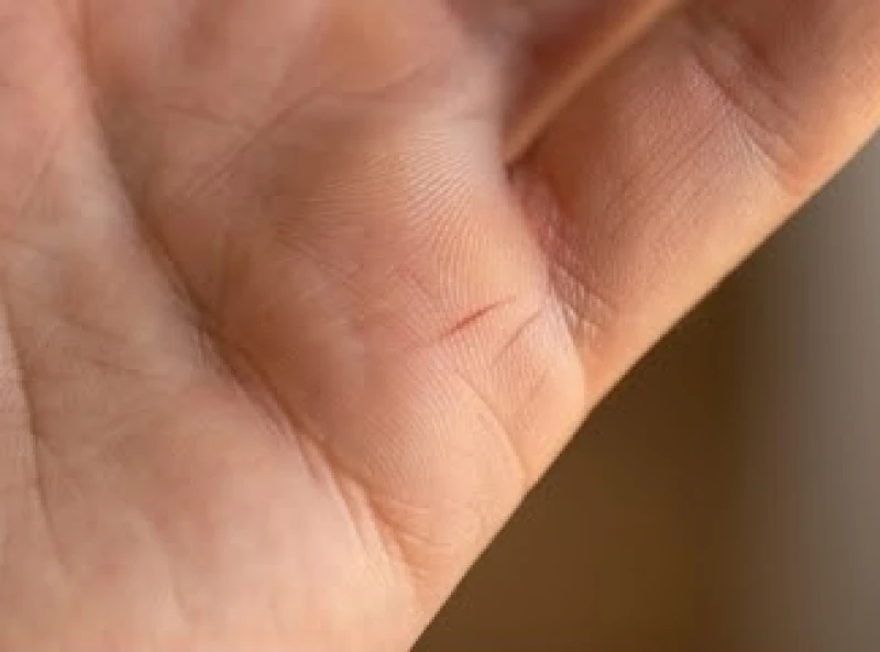 Vết nứt gãy rõ rệt chia đôi đường chỉ tay nhỏ nằm ngang mép lòng bàn tay dưới gốc ngón út