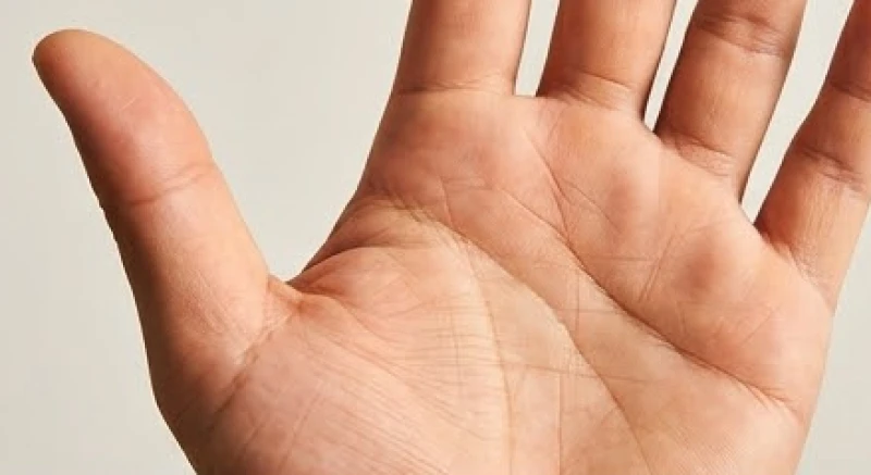 Khoảng cách tách biệt rõ ràng giữa đường Trí đạo và Sinh đạo trên lòng bàn tay chữ Xuyên