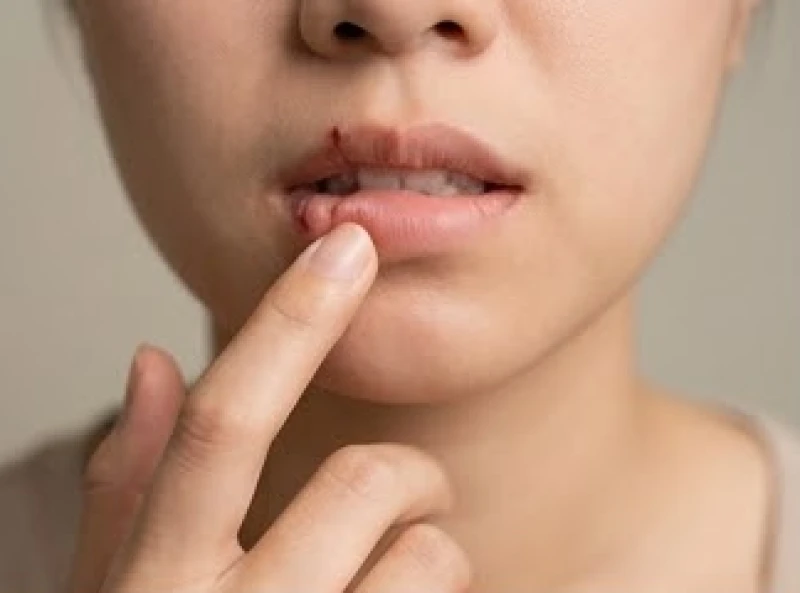Vết rướm máu nhẹ trên môi thể hiện sự mất tập trung khi nhai thức ăn