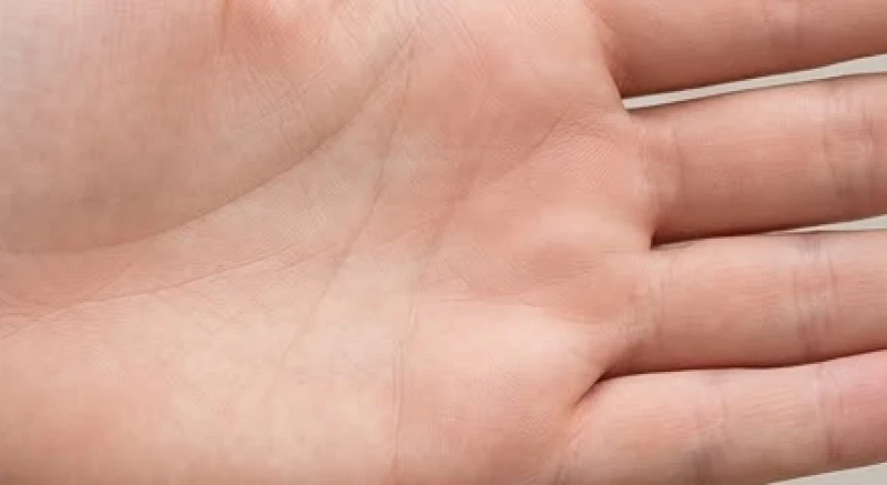 Bề mặt biểu bì phẳng lì từ gót tay lên đến các đốt ngón tay không có nếp gấp lõm