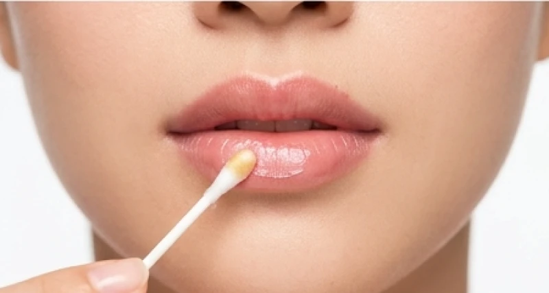 Vùng da quanh miệng đang được làm dịu và phục hồi nhẹ nhàng bằng sản phẩm chăm sóc chuyên dụng sau laser