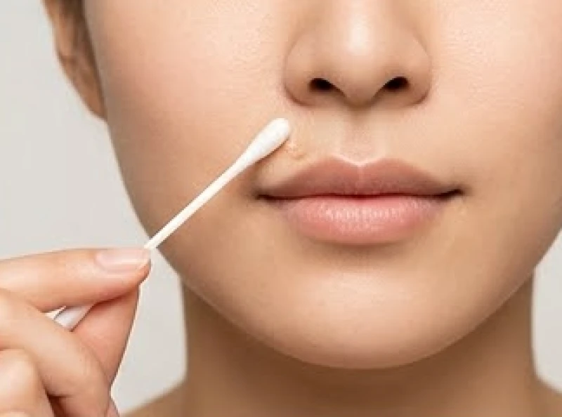 Nốt ruồi dưới mũi: Ý nghĩa tướng số nam nữ & vị trí nhân trung 6 Làm sạch vùng da vừa tẩy nốt ruồi bằng tăm bông và nước muối sinh lý cẩn thận