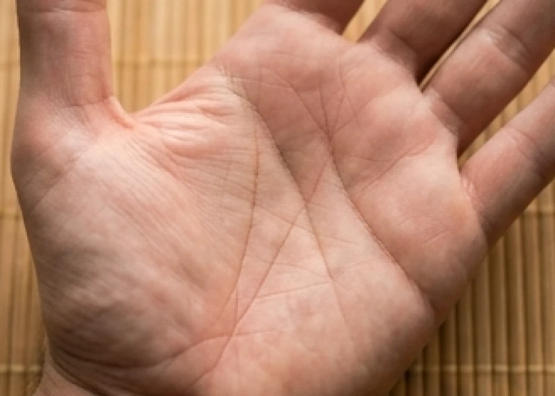 Cận cảnh lòng bàn tay có chỉ tay hình tam giác được tạo thành từ các đường nét sâu và khép kín
