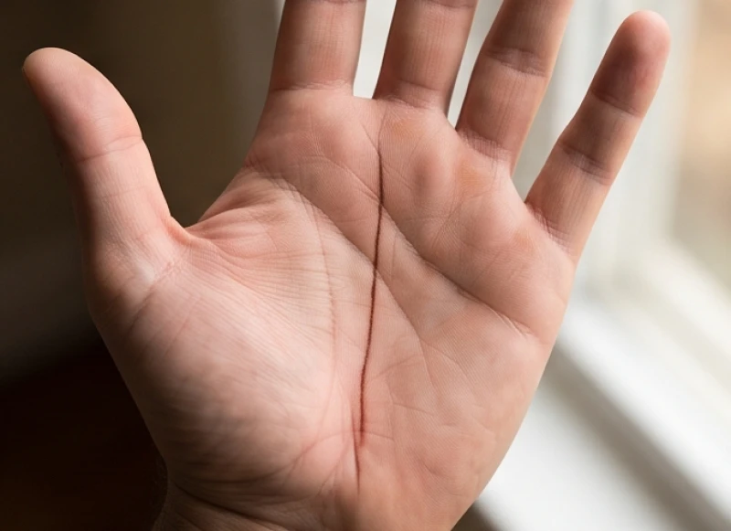 Lòng bàn tay phải của nam giới với một đường vạch dọc trung tâm thẳng tắp và sâu đậm