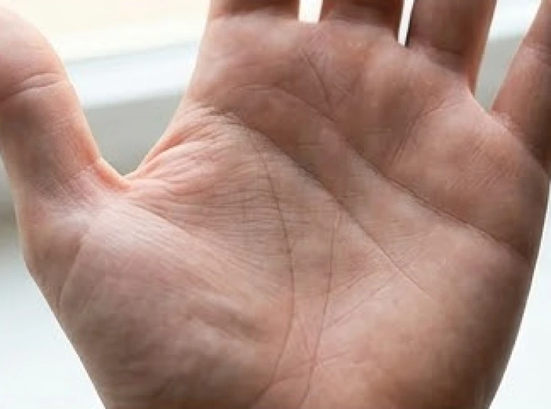 Rãnh vân phụ kéo dài từ mép ngón út đâm xuyên qua đường vòng cung sinh đạo phía gốc ngón cái trên lòng bàn tay