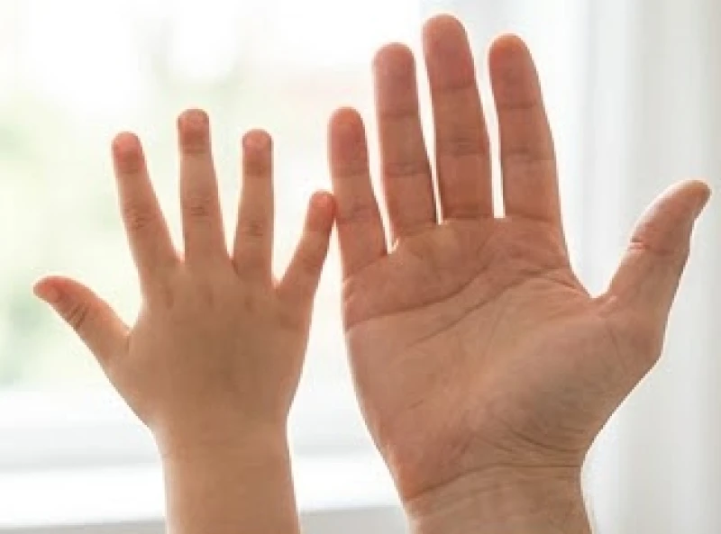 Ngón cái cong ra sau: Ý nghĩa tướng số và góc đo chuẩn y khoa 2 Bàn tay của trẻ em và người lớn đặt cạnh nhau cùng hiển thị đặc điểm ngón cái cong ngược