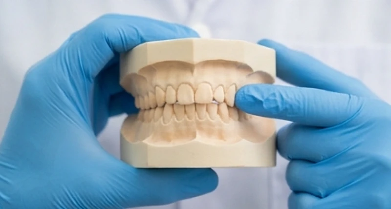 Bác sĩ nha khoa đo lường góc độ mọc lệch của chiếc răng nanh trên mô hình hàm