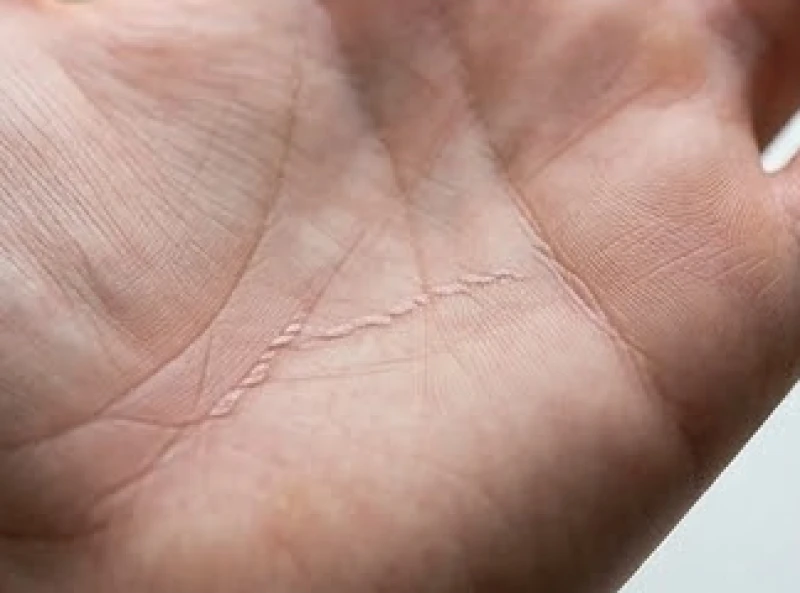Vân tay mờ nhạt nằm ngay sát gò Thái Âm uốn lượn ngoằn ngoèo tạo thành kết cấu như hình dây xích nối tiếp nhau