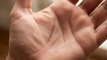 Đường chỉ tay quý nhân phù trợ xuất hiện rõ nét trên gò Kim Tinh ở gốc ngón tay cái