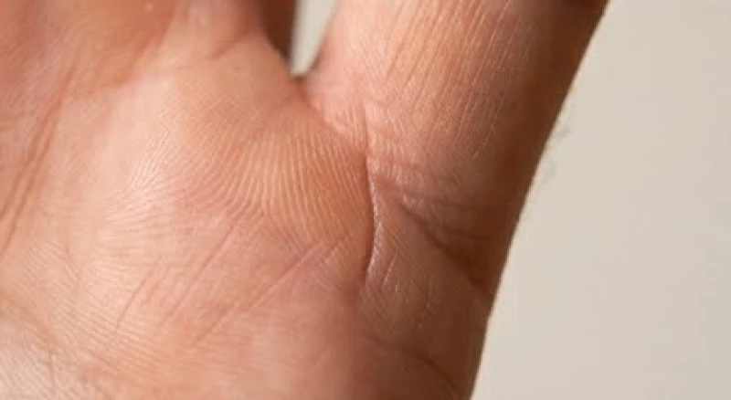 Đường chỉ tay chia nhánh hình chữ Y ở gốc ngón út báo hiệu lộc sinh đôi