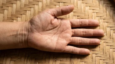 Cận cảnh lòng bàn tay phân tích ý nghĩa của đường chỉ tay sinh mệnh đứt đoạn để nhận biết tình trạng sức khỏe