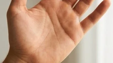 Bàn tay có đường hôn nhân có hai đường rõ nét nằm ngang trên gò Thủy Tinh dưới gốc ngón út