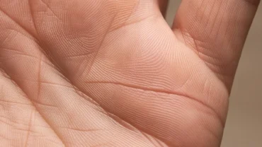 Bàn tay xòe rộng hiển thị rõ nét đường hôn nhân dài và đậm nét nằm ngang ở mép bàn tay dưới ngón út