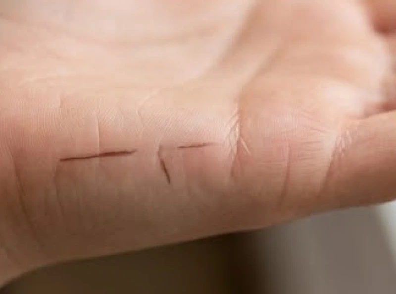 Đường chỉ tay tình duyên bị gãy khúc hoặc gián đoạn giữa chừng trên cạnh bàn tay