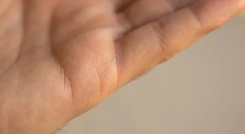 Khu vực dưới ngón út hiển thị hai đường Hôn Nhân nhỏ ngắn chạy ngang rìa mép bàn tay