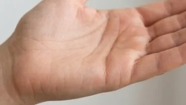 Vị trí đường hôn nhân ở nữ giới trên cạnh bàn tay phải nằm ngay dưới ngón út