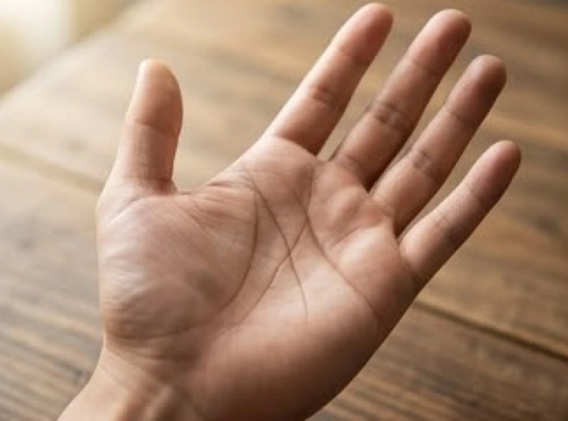Bàn tay mở rộng với một đường chỉ sinh đạo tách đôi tạo thành vân đảo rõ nét ở giữa lòng bàn tay