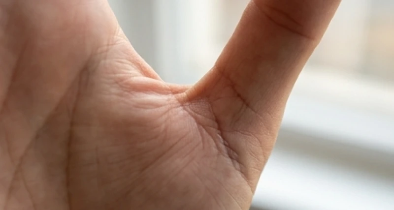 Nhận biết đường chỉ tay xấu: phân cấp rủi ro và cách hóa giải 5 Đường Sinh Đạo bị đứt đoạn nhưng có một nhánh chỉ phụ bọc lót bên cạnh