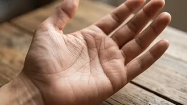 Bàn tay lật ngửa với các đường chỉ tay rõ nét, thể hiện đặc điểm đường sinh mệnh có đảo phản ánh tình trạng sức khỏe