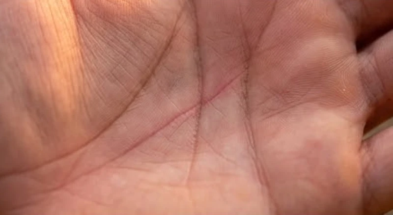So sánh đường sinh mệnh dài đậm nét với các hình thái chỉ tay nông và mờ nhạt