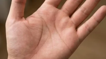 Bàn tay ngửa lên lộ rõ đường sinh mệnh ngắn nhưng in hằn sâu đậm dưới ánh sáng tự nhiên