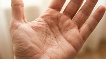 Bàn tay mở rộng hiển thị rõ đường sự nghiệp ngắn chạy từ cổ tay và dừng lại giữa chừng ở lòng bàn tay