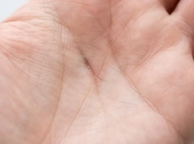 Đường sủng ái cực ngắn nằm vắt chéo nhẹ ngay sát mép đường Tâm Đạo bên dưới ngón út