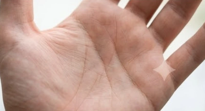 Gò Thái Dương trên bàn tay: Giải mã ký hiệu và cách cải vận 8 Đường chỉ tay dọc chạy hướng lên ngón áp út bị đứt gãy thành nhiều đoạn trên lòng bàn tay