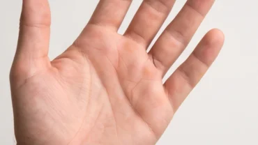 Lòng bàn tay rõ nét hiển thị đường tiền tài bị đứt đoạn dưới ngón áp út trong phong thủy