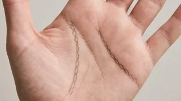 Bàn tay có đường trí đạo hình dây xích rõ nét thể hiện hệ thần kinh nhạy cảm
