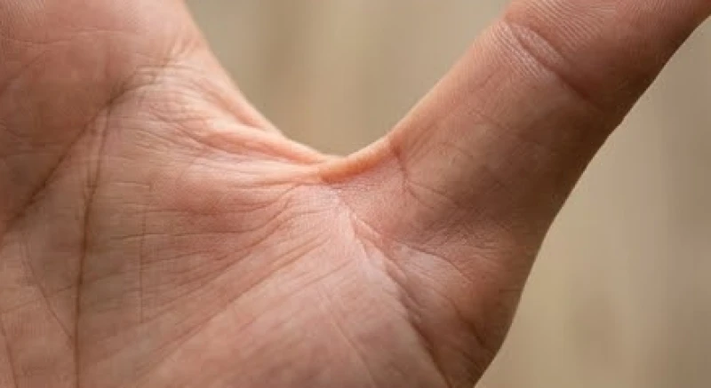 Góc nhìn nghiêng mép bàn tay làm nổi bật điểm tách rời giữa hai nếp gấp chạy về hai hướng khác nhau