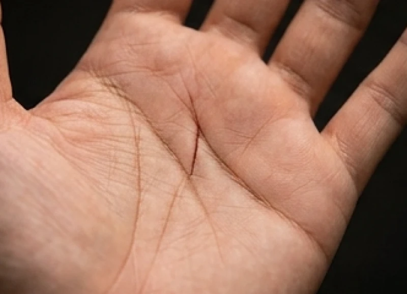 Điểm tách đôi sắc nét ngay khu vực trung tâm lòng bàn tay trên đường trí đạo