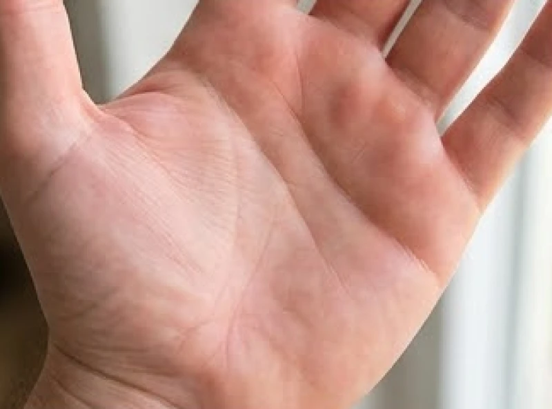 Lòng bàn tay có các gò đệm thịt đầy đặn, nảy nở đan xen với bề mặt da mềm mại căng tràn sức sống.