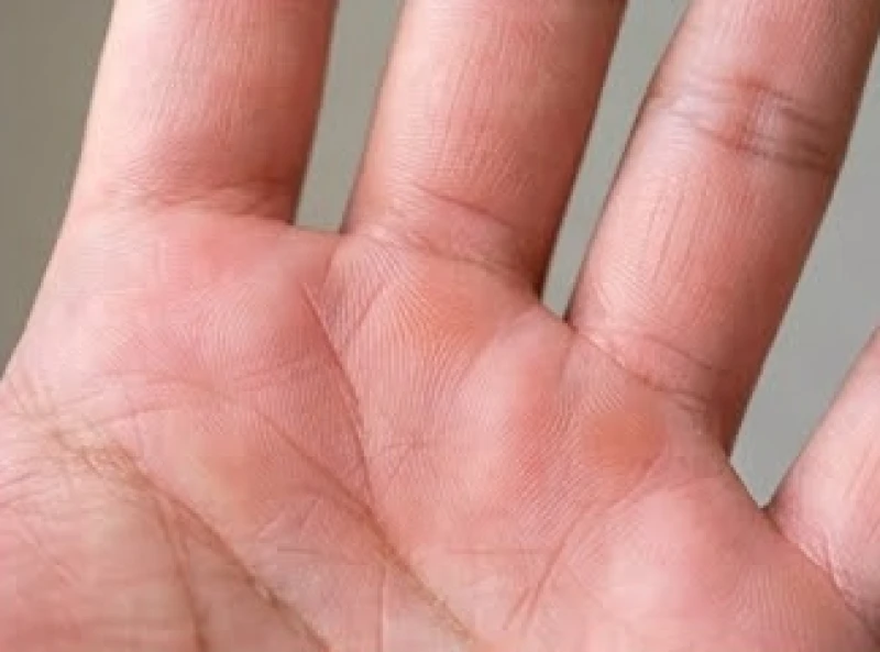 Gò Mộc Tinh và gò Thái Dương đầy đặn trên lòng bàn tay báo hiệu sự thăng tiến