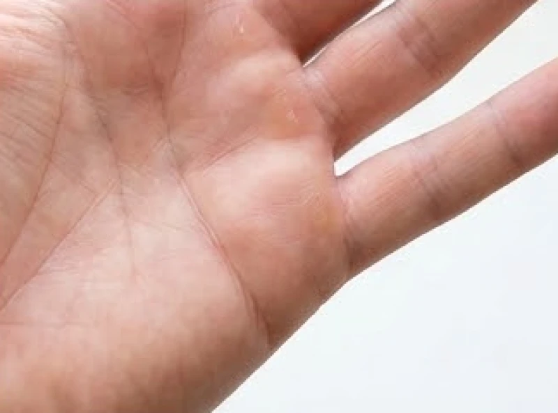 Phần rìa lòng bàn tay dưới ngón áp út và ngón út nhô cao, nơi hội tụ năng lượng của tài nghệ thuật.