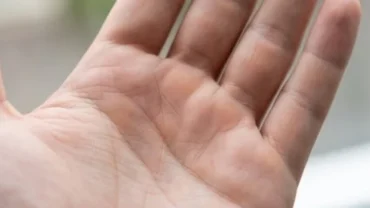 Lòng bàn tay mở rộng hiển thị gò thái dương trên bàn tay nhô cao tượng trưng cho tài lộc và danh vọng