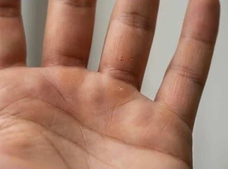 Nốt ruồi trong lòng bàn tay trái nam: Luận từng gò và đường chỉ 6 Vị trí nốt ruồi tại gò Thổ Tinh ngay dưới gốc ngón giữa của bàn tay nam giới