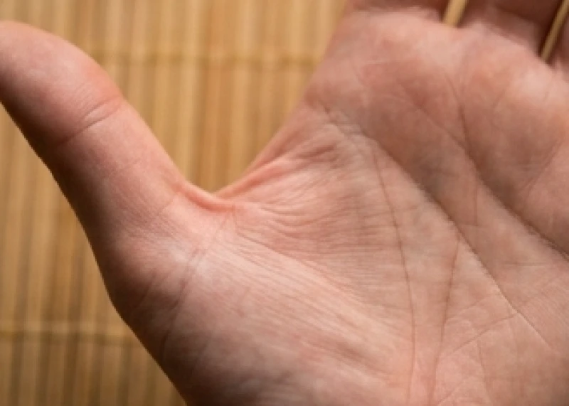 Khu vực gò Kim tinh nằm ở gốc ngón tay cái nổi bật với đường chỉ tay tam giác khép kín hoàn toàn
