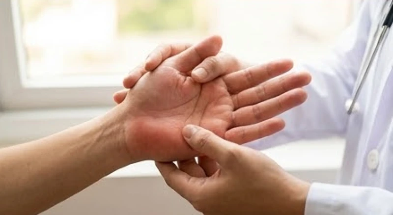 Bác sĩ đang kiểm tra tình trạng ửng đỏ bất thường tại các gò thịt trên lòng bàn tay của bệnh nhân