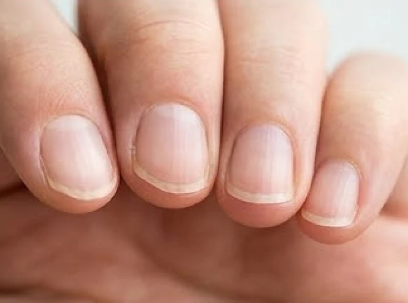 Kiểm tra kỹ phần khe móng tay dưới ánh sáng để phát hiện bất thường