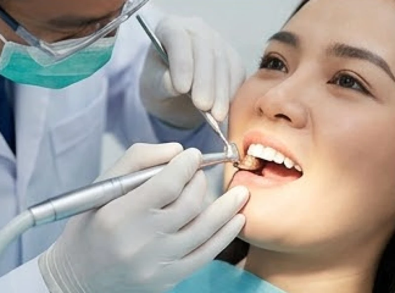 Tướng răng cửa to: Giải mã vận mệnh nam nữ và bảng giá làm nhỏ 9 Thao tác mài men răng được thực hiện tỉ mỉ với tỷ lệ cực nhỏ để bảo vệ tối đa cấu trúc tủy