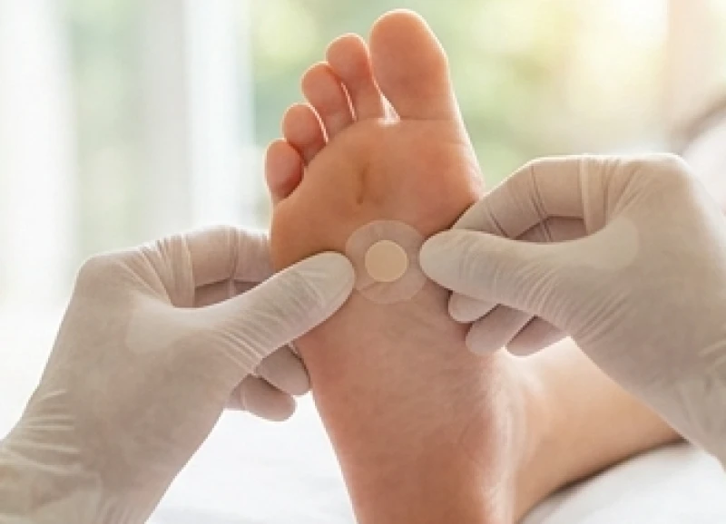 Sử dụng miếng dán y tế để bảo vệ nốt ruồi ở lòng bàn chân khỏi lực ma sát