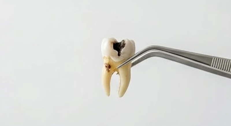 Mơ thấy tự nhổ răng mình: Giải mã ý nghĩa từng vị trí và con số 4 Việc nhổ bỏ chiếc răng sâu hư hỏng trong mơ đại diện cho sự giải thoát khỏi những vấn đề tồn đọng dai dẳng