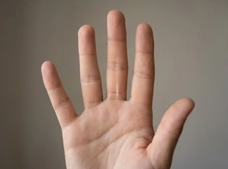 Dùng khe hở giữa ngón giữa và ngón út làm mốc thẳng đứng để định vị tâm của gò thái dương trên bàn tay